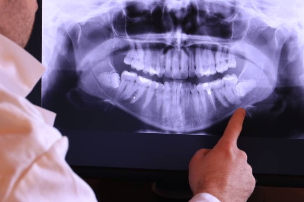 Best Urgent Tooth Repair  in Ruckersville, VA